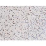 Phospho-SYK (Tyr525) Antibody in Immunohistochemistry (Paraffin) (IHC (P))