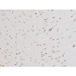 Phospho-SYK (Tyr525) Antibody in Immunohistochemistry (Paraffin) (IHC (P))