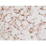 Phospho-SYK (Tyr525) Antibody in Immunohistochemistry (Paraffin) (IHC (P))