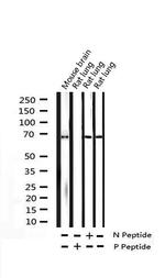 Phospho-SYK (Tyr525) Antibody in Western Blot (WB)