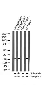 Phospho-p27 Kip1 (Thr187) Antibody in Western Blot (WB)