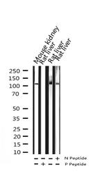 Phospho-PLA2G4A (Ser505) Antibody in Western Blot (WB)