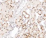 Phospho-C/EBP alpha (Ser21) Antibody in Immunohistochemistry (Paraffin) (IHC (P))