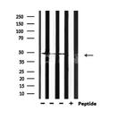 Phospho-GSK3 alpha/beta (Tyr279, Tyr216) Antibody in Western Blot (WB)