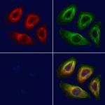 Phospho-ETK (Tyr566) Antibody in Immunocytochemistry (ICC/IF)