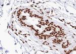 Phospho-STAT2 (Tyr690) Antibody in Immunohistochemistry (Paraffin) (IHC (P))