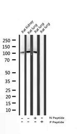 Phospho-STAT2 (Tyr690) Antibody in Western Blot (WB)