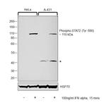 Phospho-STAT2 (Tyr690) Antibody in Western Blot (WB)