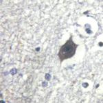 Phospho-LIMK2 (Ser283) Antibody in Immunohistochemistry (Paraffin) (IHC (P))