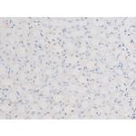 Phospho-LIMK2 (Ser283) Antibody in Immunohistochemistry (Paraffin) (IHC (P))