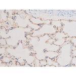 Phospho-LIMK2 (Ser283) Antibody in Immunohistochemistry (Paraffin) (IHC (P))