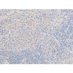 Phospho-LIMK2 (Ser283) Antibody in Immunohistochemistry (Paraffin) (IHC (P))