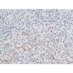 Phospho-LIMK2 (Ser283) Antibody in Immunohistochemistry (Paraffin) (IHC (P))