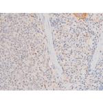 Phospho-LIMK2 (Ser283) Antibody in Immunohistochemistry (Paraffin) (IHC (P))