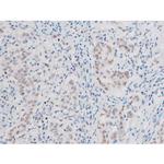 Phospho-LIMK2 (Ser283) Antibody in Immunohistochemistry (Paraffin) (IHC (P))