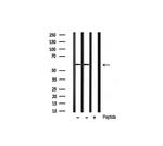 Phospho-Smad3 (Ser425) Antibody in Western Blot (WB)