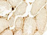 Phospho-Smad3 (Ser425) Antibody in Immunohistochemistry (Paraffin) (IHC (P))