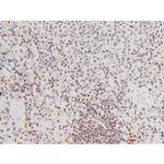 Phospho-FOXO4 (Thr451) Antibody in Immunohistochemistry (Paraffin) (IHC (P))