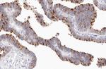 Phospho-NFkB p100 (Ser870) Antibody in Immunohistochemistry (Paraffin) (IHC (P))