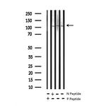 Phospho-NFkB p100 (Ser870) Antibody in Western Blot (WB)