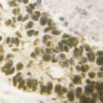 Phospho-RUNX1 (Ser304) Antibody in Immunohistochemistry (Paraffin) (IHC (P))