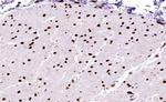 Phospho-MEF2A (Thr312) Antibody in Immunohistochemistry (Paraffin) (IHC (P))