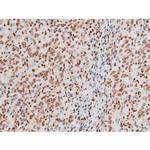 Phospho-NFkB p65 (Thr435) Antibody in Immunohistochemistry (Paraffin) (IHC (P))