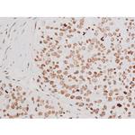 Phospho-NFkB p65 (Thr435) Antibody in Immunohistochemistry (Paraffin) (IHC (P))