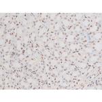 Phospho-NFkB p65 (Thr435) Antibody in Immunohistochemistry (Paraffin) (IHC (P))