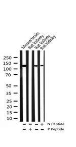 Phospho-NMDAR1 (Ser897) Antibody in Western Blot (WB)