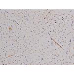 Phospho-Bcl-xL (Thr47) Antibody in Immunohistochemistry (Paraffin) (IHC (P))