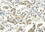 Phospho-FOXO1 (Ser256) Antibody in Immunohistochemistry (Paraffin) (IHC (P))