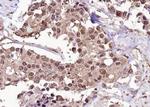 Phospho-FOXO1 (Ser256) Antibody in Immunohistochemistry (Paraffin) (IHC (P))