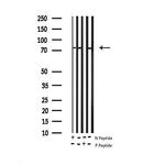 Phospho-FOXO1 (Ser256) Antibody in Western Blot (WB)