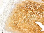 Phospho-Acetyl-CoA Carboxylase (Ser80) Antibody in Immunohistochemistry (Paraffin) (IHC (P))