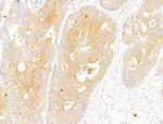 Phospho-Acetyl-CoA Carboxylase (Ser80) Antibody in Immunohistochemistry (Paraffin) (IHC (P))