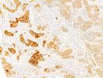 Phospho-Acetyl-CoA Carboxylase (Ser80) Antibody in Immunohistochemistry (Paraffin) (IHC (P))