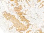 Phospho-Acetyl-CoA Carboxylase (Ser80) Antibody in Immunohistochemistry (Paraffin) (IHC (P))