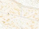 Phospho-Acetyl-CoA Carboxylase (Ser80) Antibody in Immunohistochemistry (Paraffin) (IHC (P))