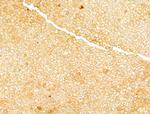 Phospho-Acetyl-CoA Carboxylase (Ser80) Antibody in Immunohistochemistry (Paraffin) (IHC (P))