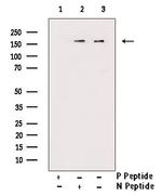 Phospho-NMDAR2B (Tyr1336) Antibody in Western Blot (WB)