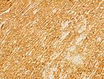 Phospho-CaMKII beta/gamma/delta (Thr287) Antibody in Immunohistochemistry (Paraffin) (IHC (P))