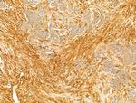 Phospho-CaMKII beta/gamma/delta (Thr287) Antibody in Immunohistochemistry (Paraffin) (IHC (P))