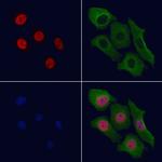 Phospho-TRAP220 (Thr1457) Antibody in Immunocytochemistry (ICC/IF)