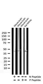 Phospho-IkappaB beta (Ser23) Antibody in Western Blot (WB)