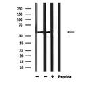 Phospho-SMAD2 (Ser467) Antibody in Western Blot (WB)