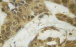 Phospho-SMAD1 (Ser187) Antibody in Immunohistochemistry (Paraffin) (IHC (P))