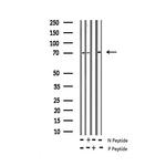 Phospho-CRMP2 (Thr514) Antibody in Western Blot (WB)