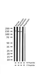 Phospho-TRKB (Tyr516) Antibody in Western Blot (WB)