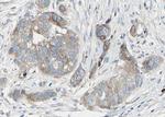 Phospho-BAD (Ser99) Antibody in Immunohistochemistry (Paraffin) (IHC (P))